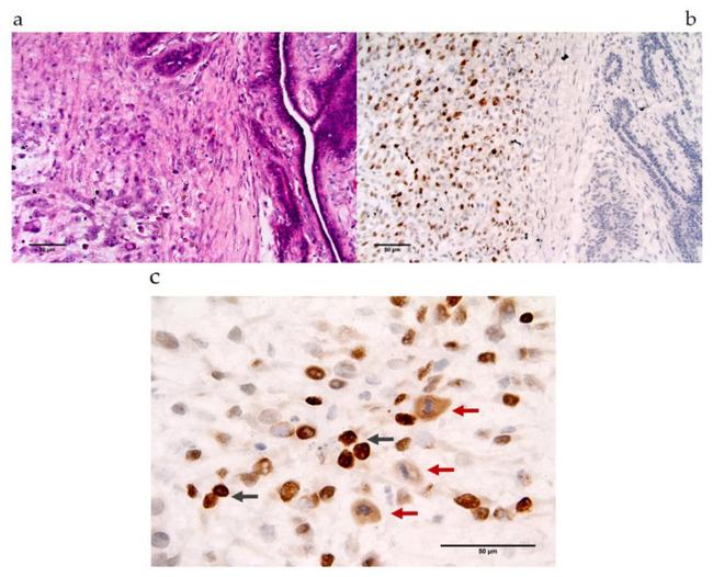 MAGE1 Antibody in Immunohistochemistry (IHC)