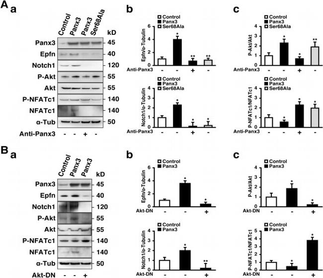 Phospho-NFATC2 (Ser326) Antibody in Western Blot (WB)