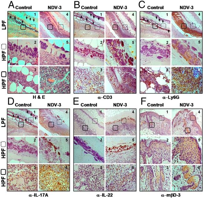 IL-17A Antibody in Immunohistochemistry (IHC)