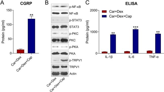 Phospho-PKA alpha (Ser338) Antibody in Western Blot (WB)