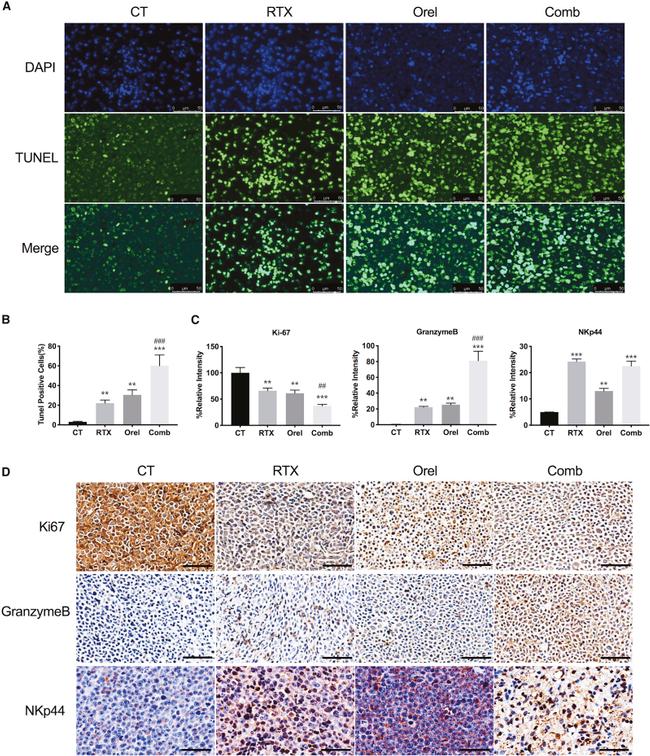 CD336 (NKp44) Antibody in Immunohistochemistry (IHC)