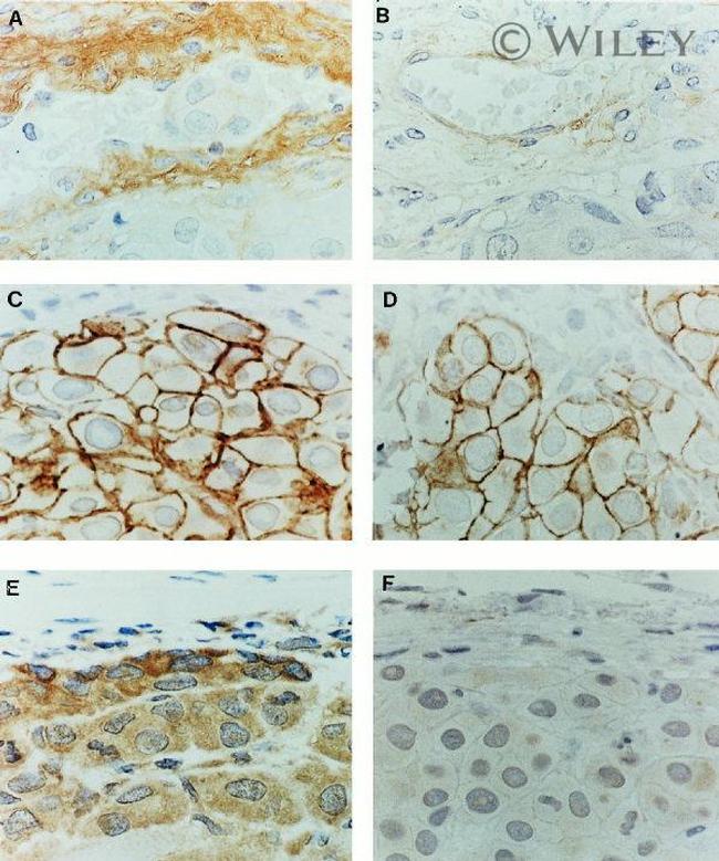 CD44var (v7-v8) Antibody in Immunohistochemistry (IHC)