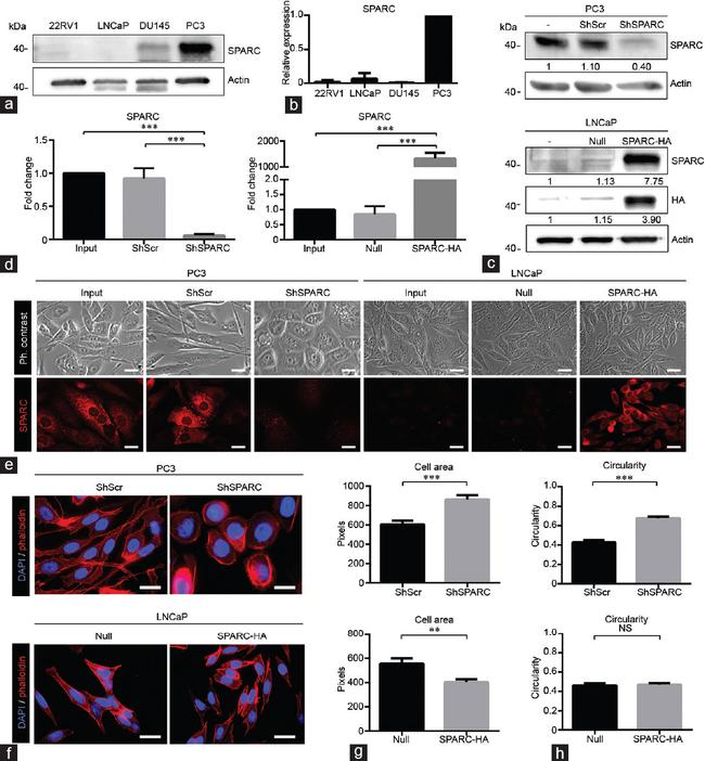 SPARC Antibody in Immunocytochemistry (ICC/IF)