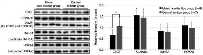 HOXA2 Antibody in Western Blot (WB)