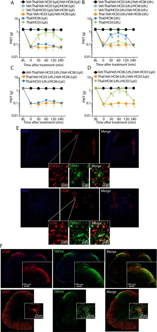 CGRP Antibody in Immunohistochemistry (IHC)