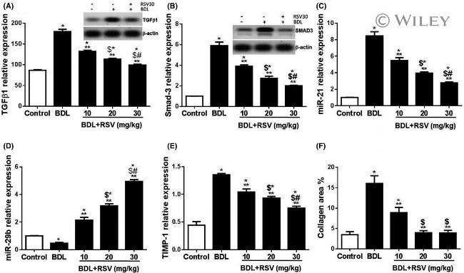 Phospho-SMAD3 (Ser423, Ser425) Antibody in Western Blot (WB)