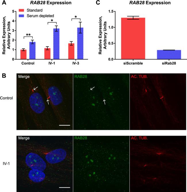 RAB28 Antibody in Immunocytochemistry (ICC/IF)