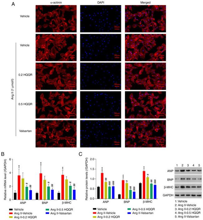 Cardiac Myosin Heavy Chain Antibody in Western Blot (WB)