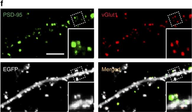 Guinea Pig IgG (H+L) Highly Cross-Adsorbed Secondary Antibody in Immunocytochemistry (ICC/IF)