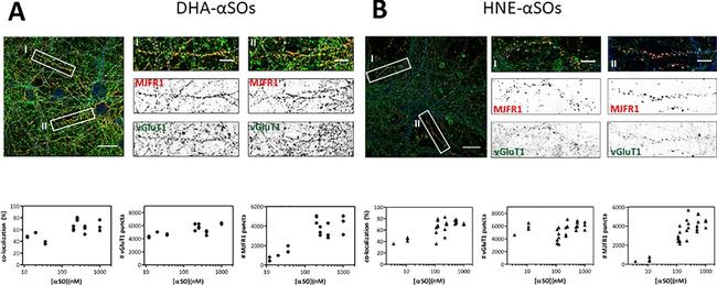 Guinea Pig IgG (H+L) Highly Cross-Adsorbed Secondary Antibody in Immunocytochemistry (ICC/IF)