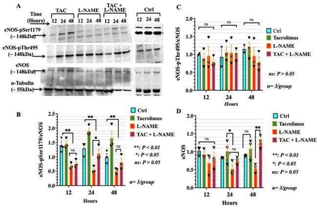 eNOS Antibody in Western Blot (WB)