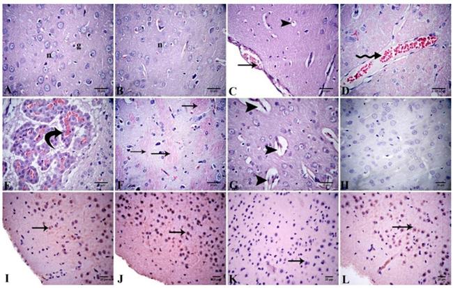 Bcl-2 Antibody in Immunohistochemistry (IHC)