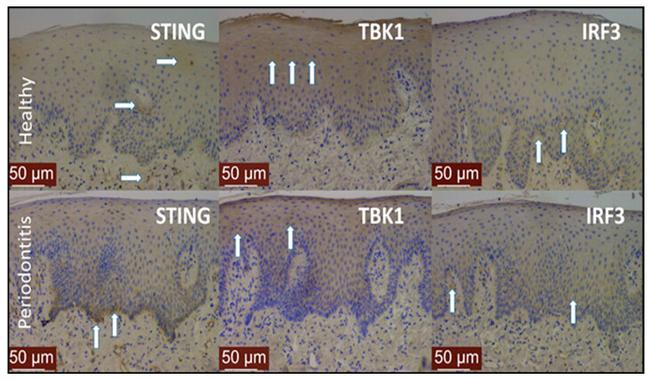 IRF3 Antibody in Immunohistochemistry (IHC)