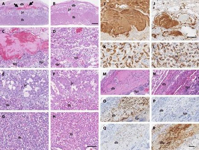 Ly-6G/Ly-6C Antibody in Immunohistochemistry (IHC)