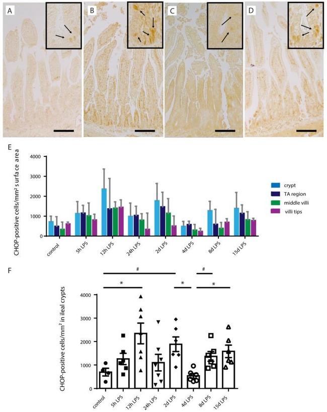 CHOP Antibody in Immunohistochemistry (Paraffin) (IHC (P))