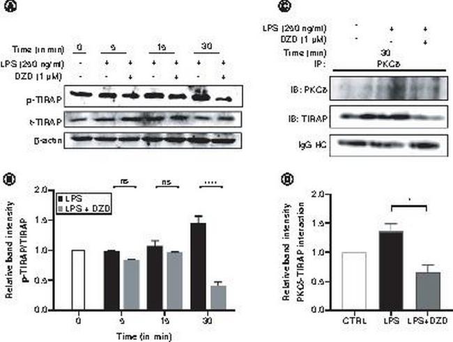 Phospho-TIRAP (Tyr86) Antibody in Western Blot (WB)