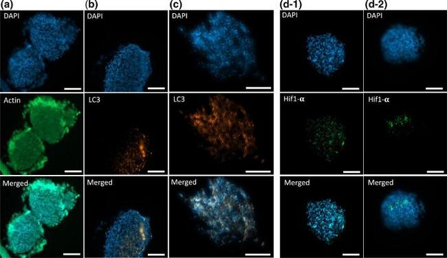 HIF1A Antibody in Immunohistochemistry (Paraffin) (IHC (P))