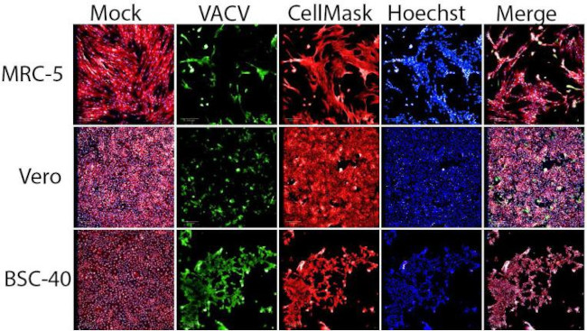 Vaccinia Virus Antibody in In vitro Assay (IV)