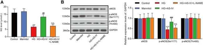 Phospho-eNOS (Thr495) Antibody in Western Blot (WB)