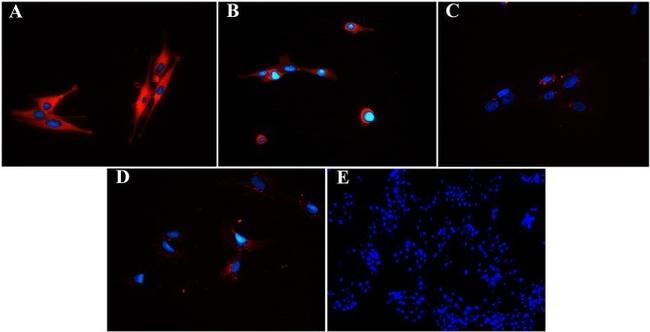 Desmoglein 3 Antibody in Immunocytochemistry (ICC/IF)