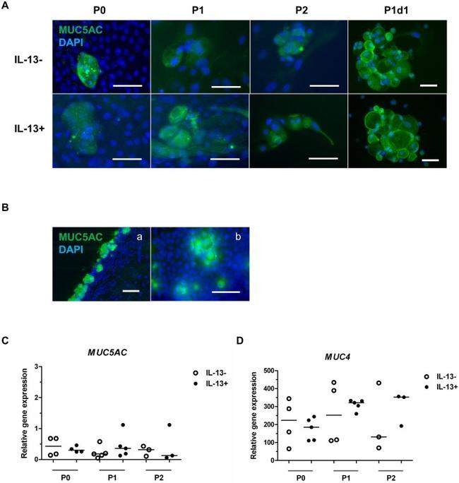 MUC5AC Antibody in Immunohistochemistry (IHC)