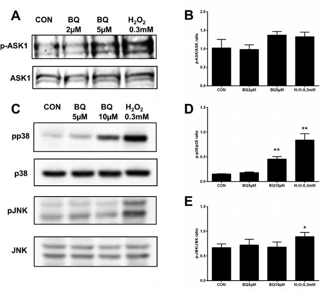 Phospho-ASK1 (Thr838) Antibody in Western Blot (WB)