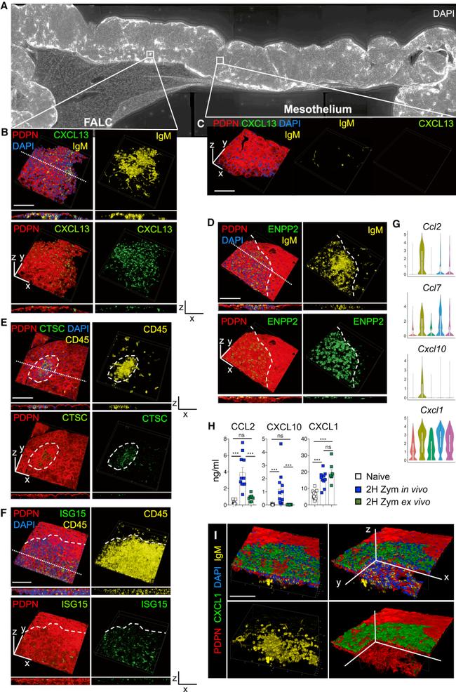 CXCL1 Antibody in Immunohistochemistry (IHC)